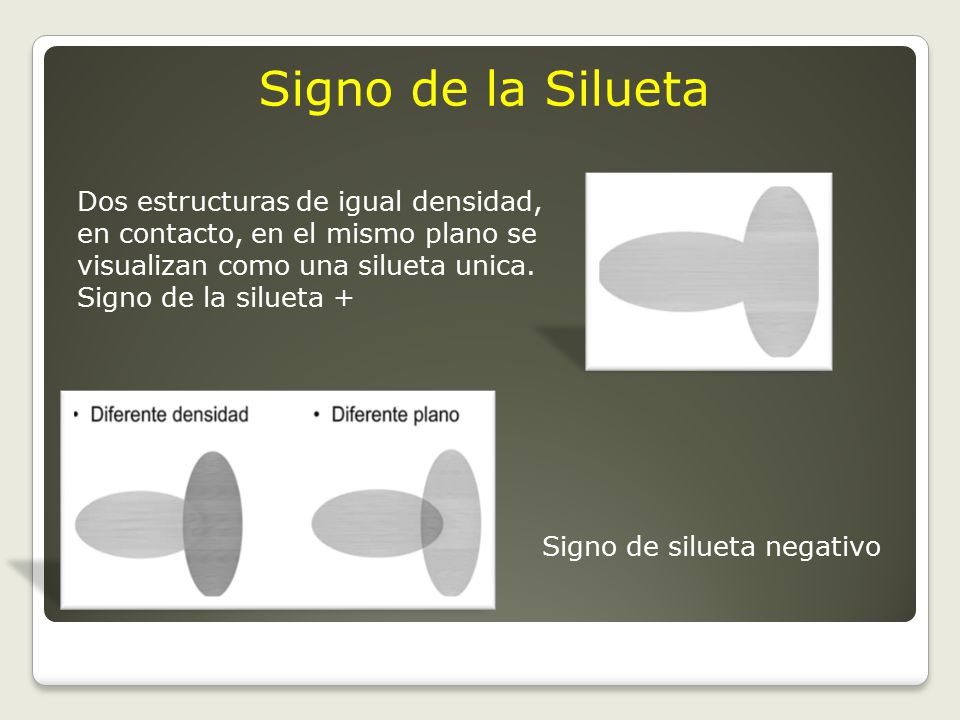 Signo de la Silueta Dos estructuras de igual densidad, en contacto, en el mismo plano se visualizan como una silueta unica. Signo de la silueta +