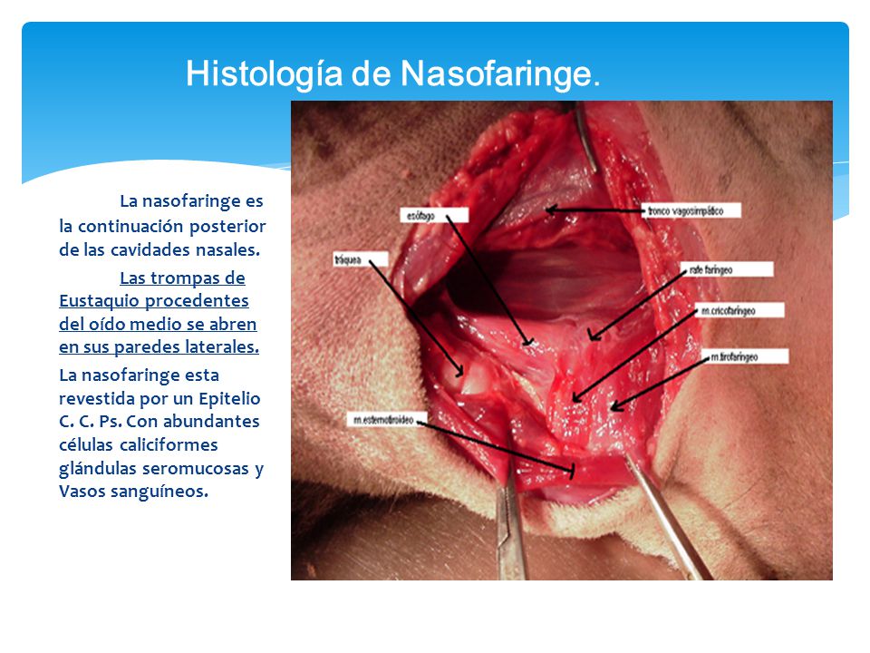 Histología de Nasofaringe.