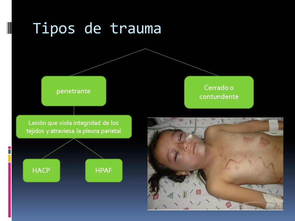 Tipos de trauma penetrante Cerrado o contundente HACP HPAF