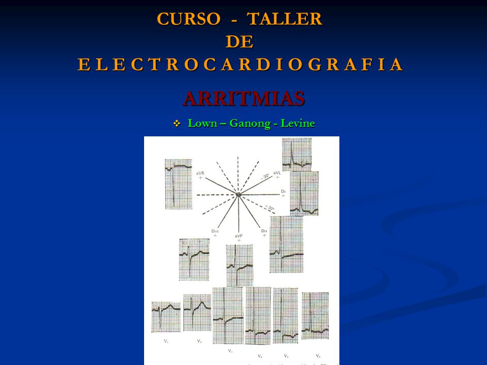CURSO - TALLER DE E L E C T R O C A R D I O G R A F I A