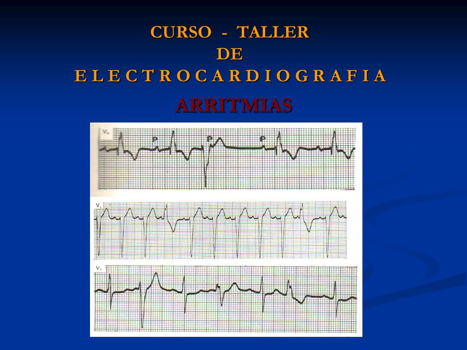 CURSO - TALLER DE E L E C T R O C A R D I O G R A F I A