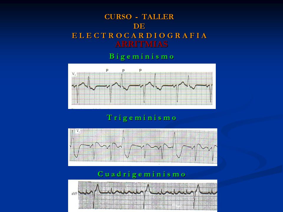 CURSO - TALLER DE E L E C T R O C A R D I O G R A F I A