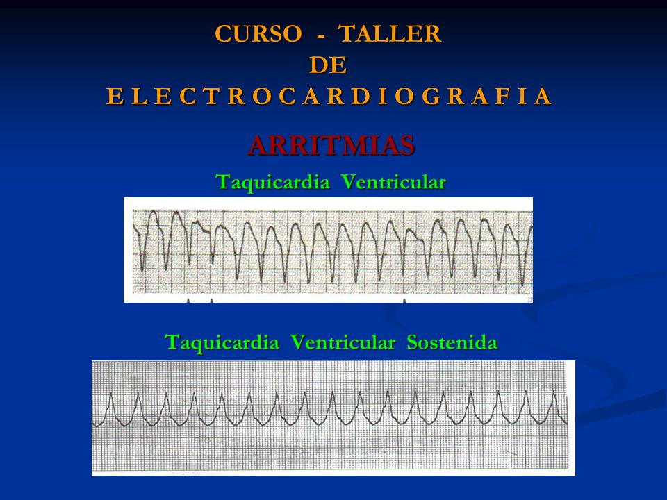 CURSO - TALLER DE E L E C T R O C A R D I O G R A F I A