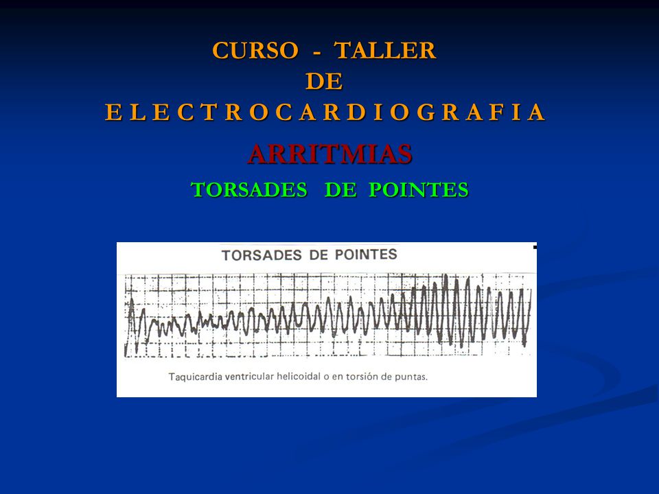 CURSO - TALLER DE E L E C T R O C A R D I O G R A F I A