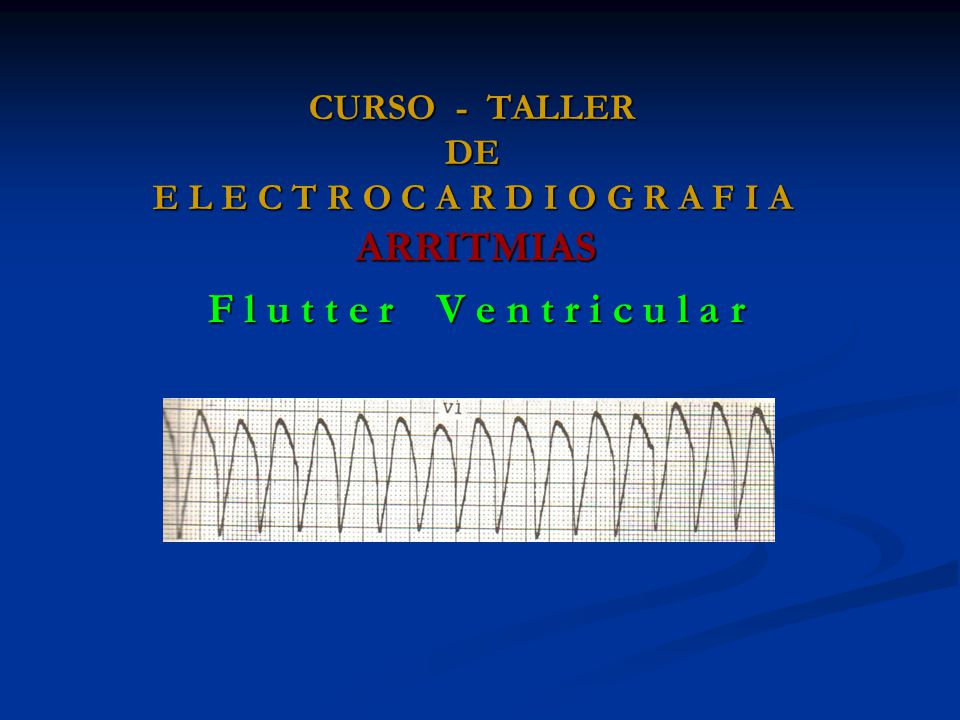 CURSO - TALLER DE E L E C T R O C A R D I O G R A F I A