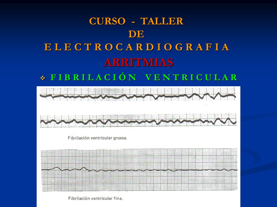 CURSO - TALLER DE E L E C T R O C A R D I O G R A F I A