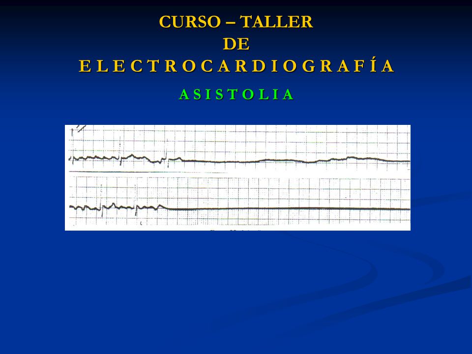 CURSO – TALLER DE E L E C T R O C A R D I O G R A F Í A