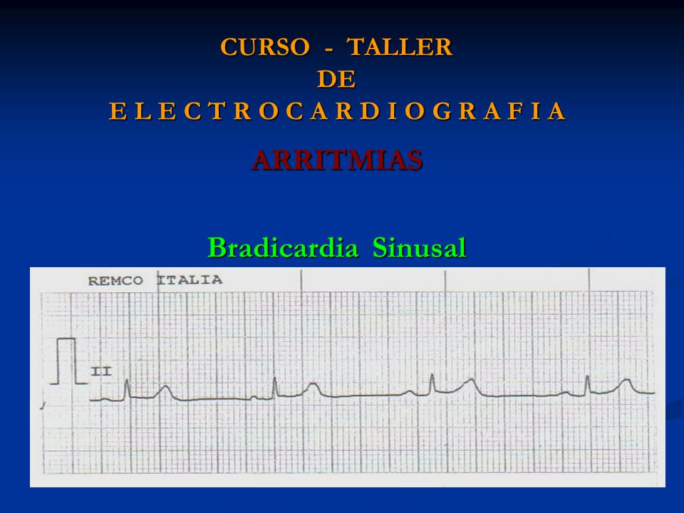 CURSO - TALLER DE E L E C T R O C A R D I O G R A F I A