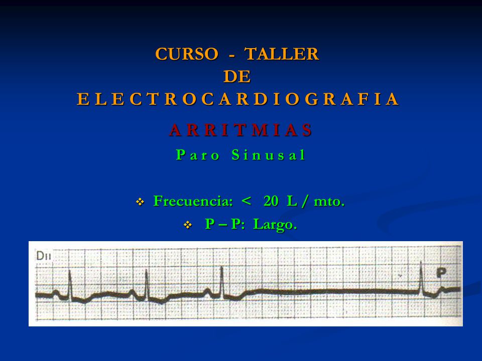 CURSO - TALLER DE E L E C T R O C A R D I O G R A F I A