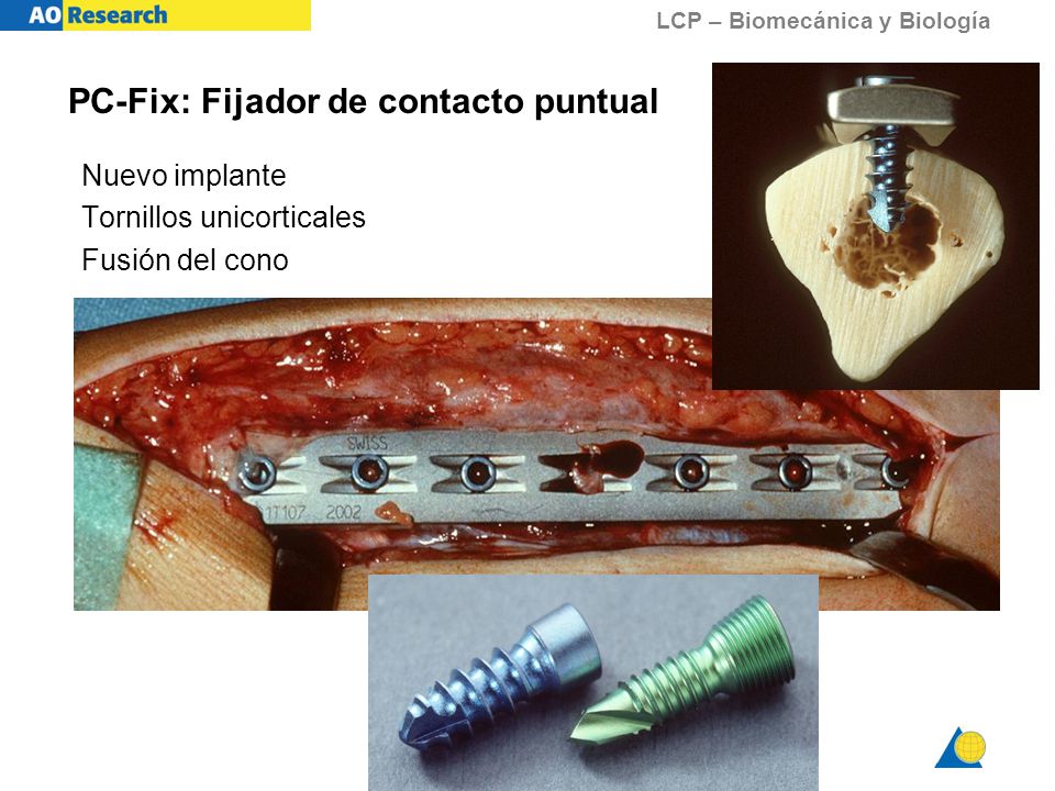 PC-Fix: Fijador de contacto puntual