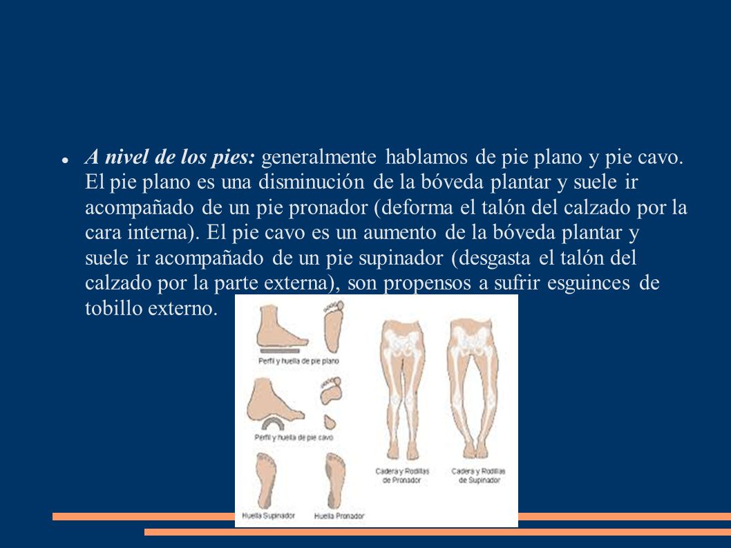A nivel de los pies: generalmente hablamos de pie plano y pie cavo