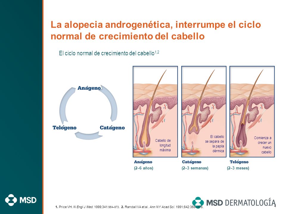 La alopecia androgenética, interrumpe el ciclo normal de crecimiento del cabello