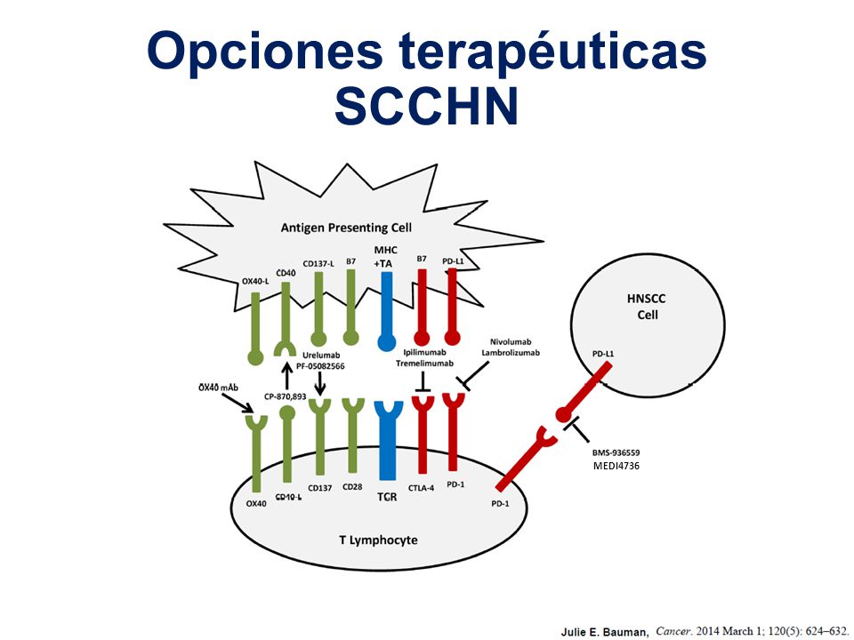Opciones terapéuticas SCCHN