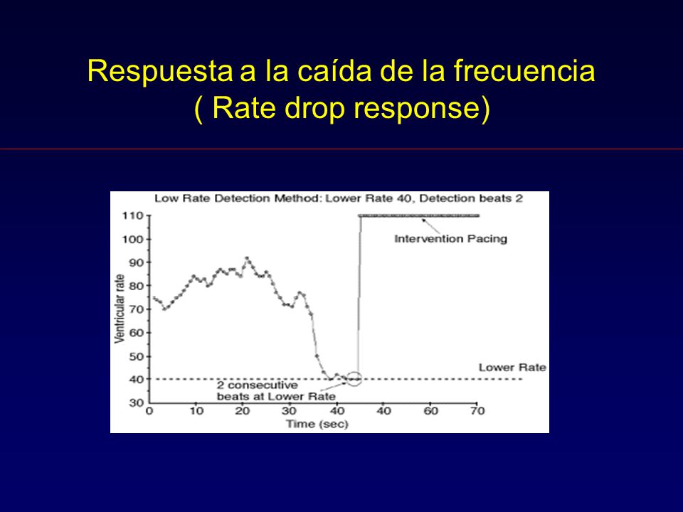Respuesta a la caída de la frecuencia ( Rate drop response)