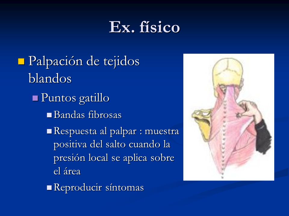 Ex. físico Palpación de tejidos blandos Puntos gatillo Bandas fibrosas