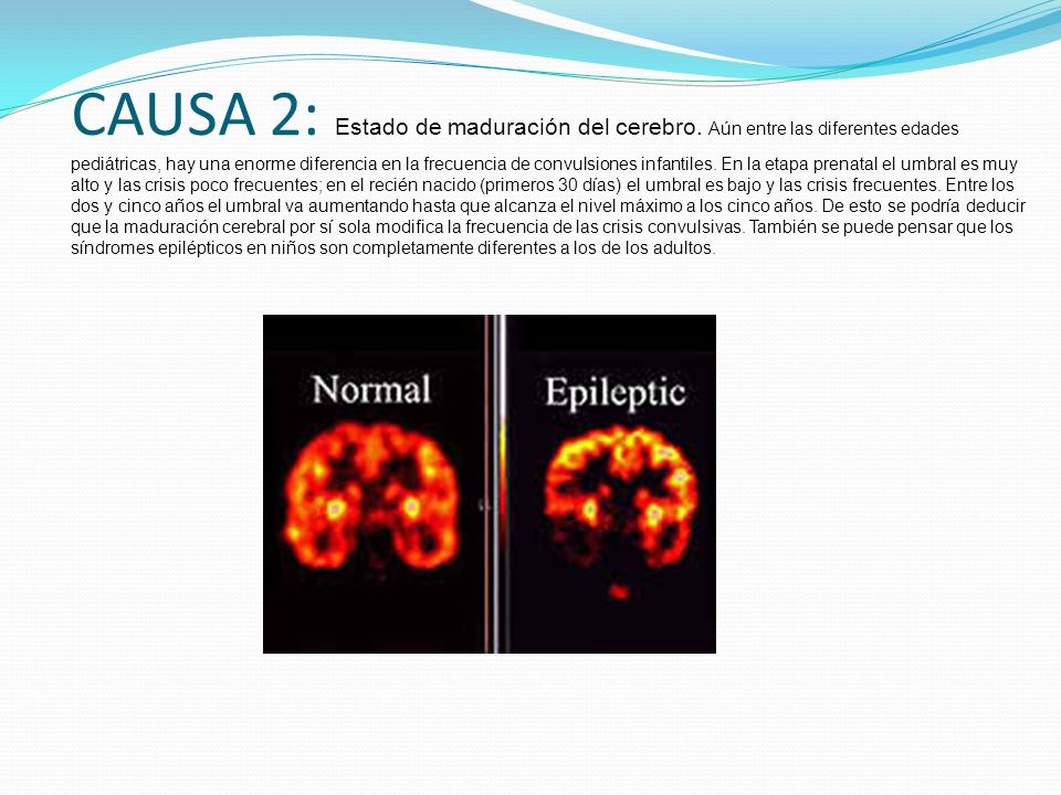 CAUSA 2: Estado de maduración del cerebro