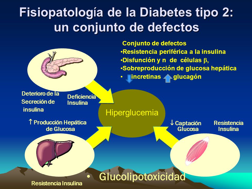 Fisiopatología de la Diabetes tipo 2: un conjunto de defectos