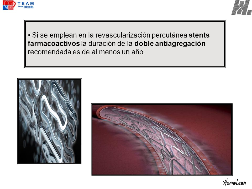 Si se emplean en la revascularización percutánea stents farmacoactivos la duración de la doble antiagregación recomendada es de al menos un año.