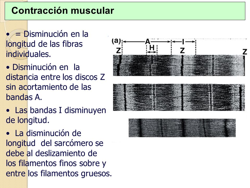 Contracción muscular = Disminución en la . longitud de las fibras individuales.