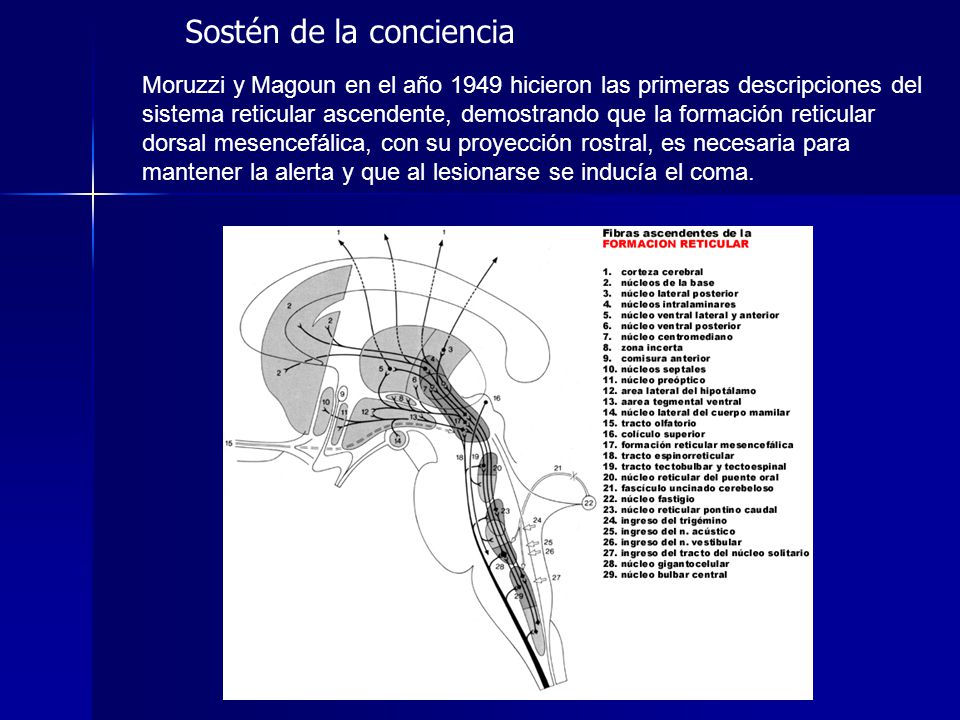 Sostén de la conciencia