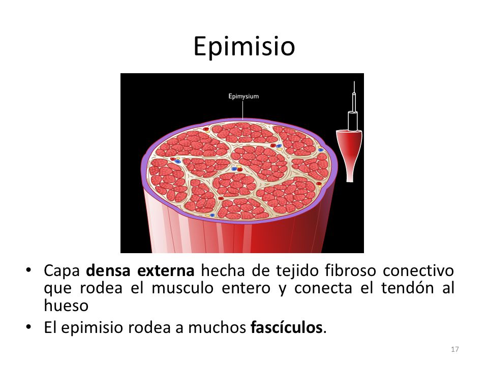 Epimisio Capa densa externa hecha de tejido fibroso conectivo que rodea el musculo entero y conecta el tendón al hueso.