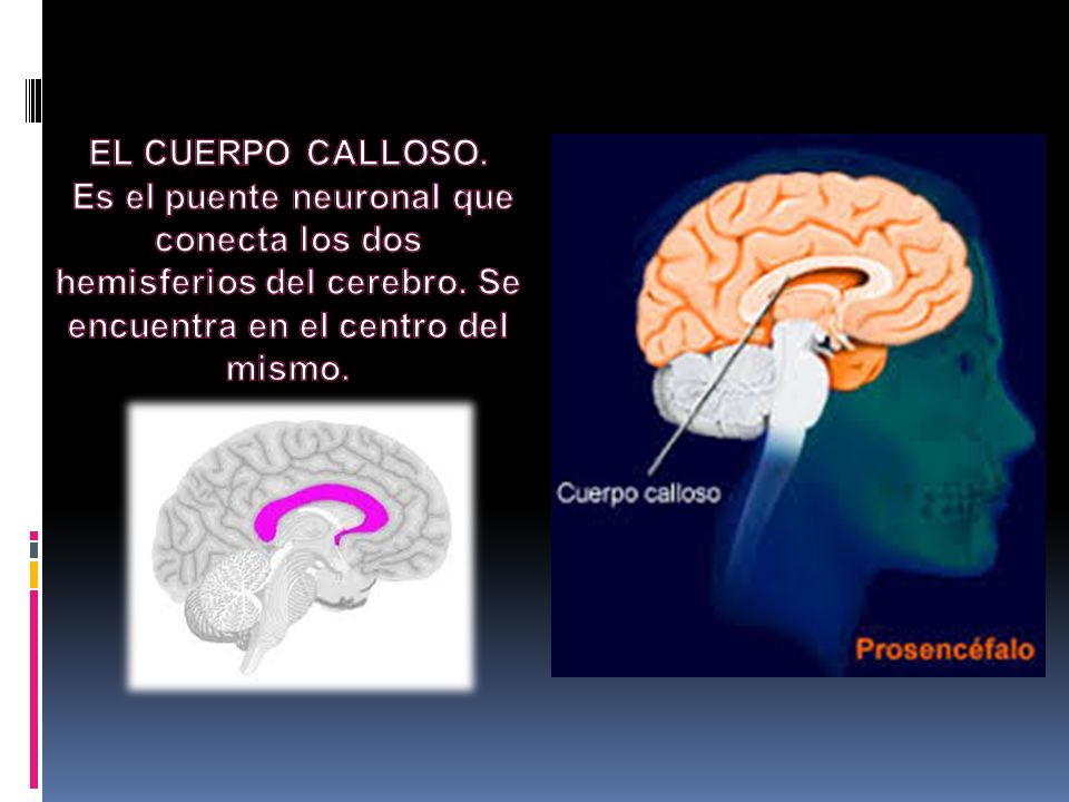 EL CUERPO CALLOSO. Es el puente neuronal que conecta los dos hemisferios del cerebro.