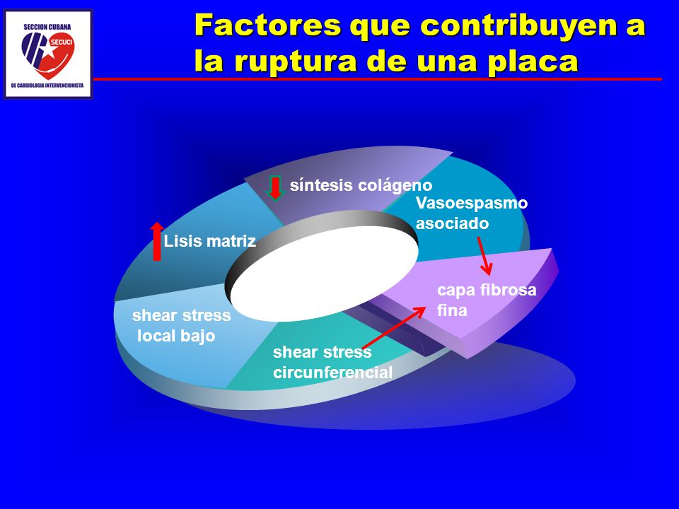 Factores que contribuyen a la ruptura de una placa