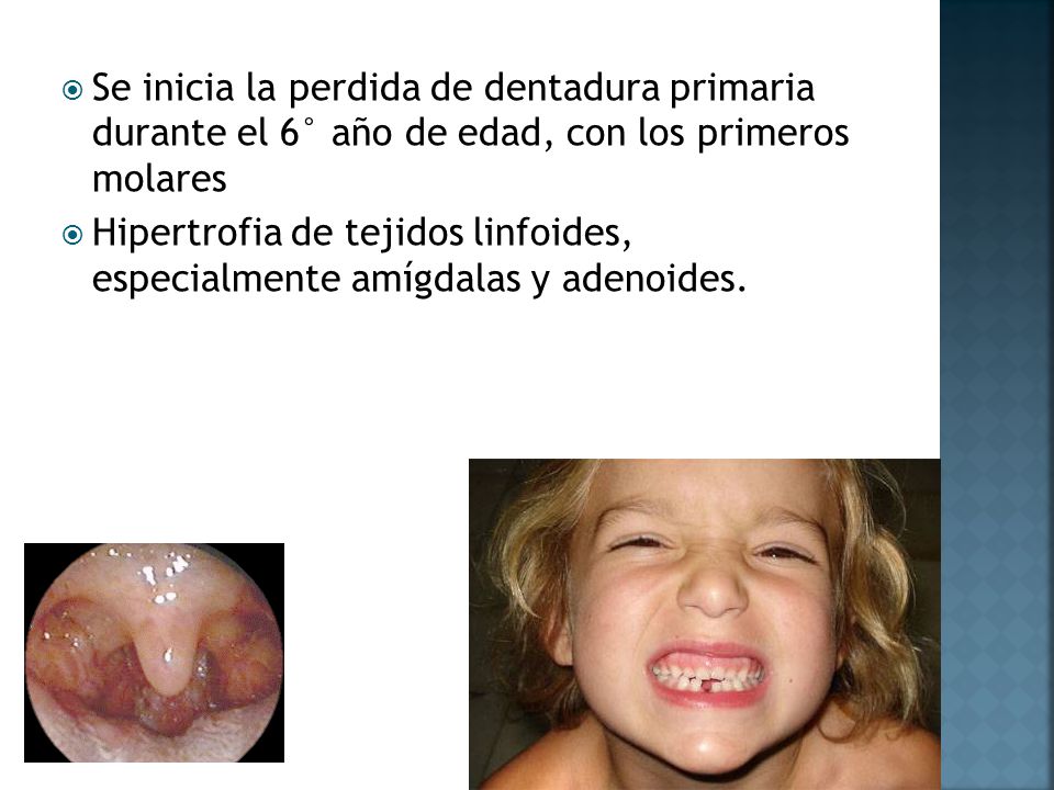 Se inicia la perdida de dentadura primaria durante el 6° año de edad, con los primeros molares