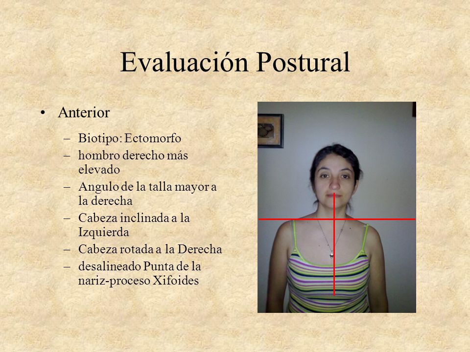 Evaluación Postural Anterior Biotipo: Ectomorfo