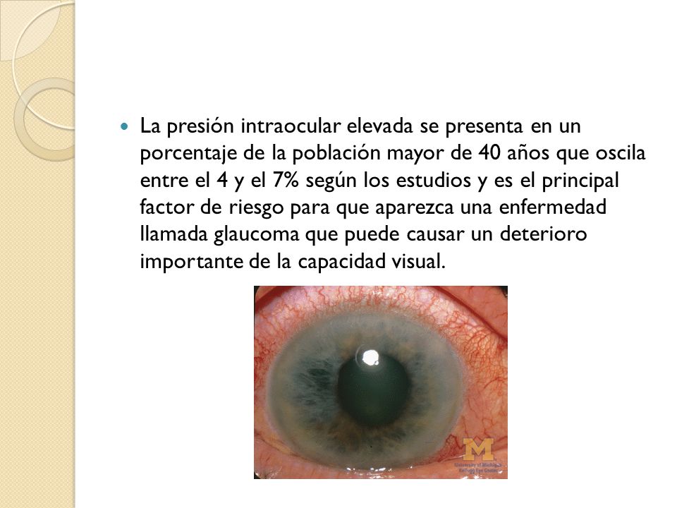 La presión intraocular elevada se presenta en un porcentaje de la población mayor de 40 años que oscila entre el 4 y el 7% según los estudios y es el principal factor de riesgo para que aparezca una enfermedad llamada glaucoma que puede causar un deterioro importante de la capacidad visual.