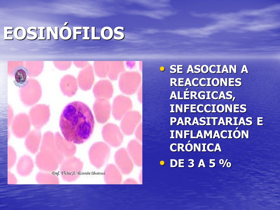 EOSINÓFILOS SE ASOCIAN A REACCIONES ALÉRGICAS, INFECCIONES PARASITARIAS E INFLAMACIÓN CRÓNICA.