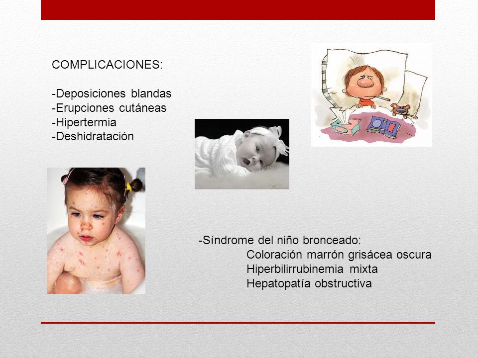 COMPLICACIONES: Deposiciones blandas. Erupciones cutáneas. Hipertermia. Deshidratación. -Síndrome del niño bronceado: