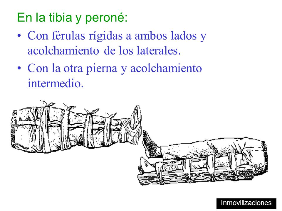 Con férulas rígidas a ambos lados y acolchamiento de los laterales.