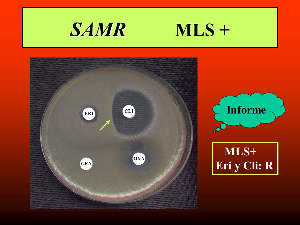 SAMR MLS + Informe CLI ERI MLS+ Eri y Cli: R OXA GEN