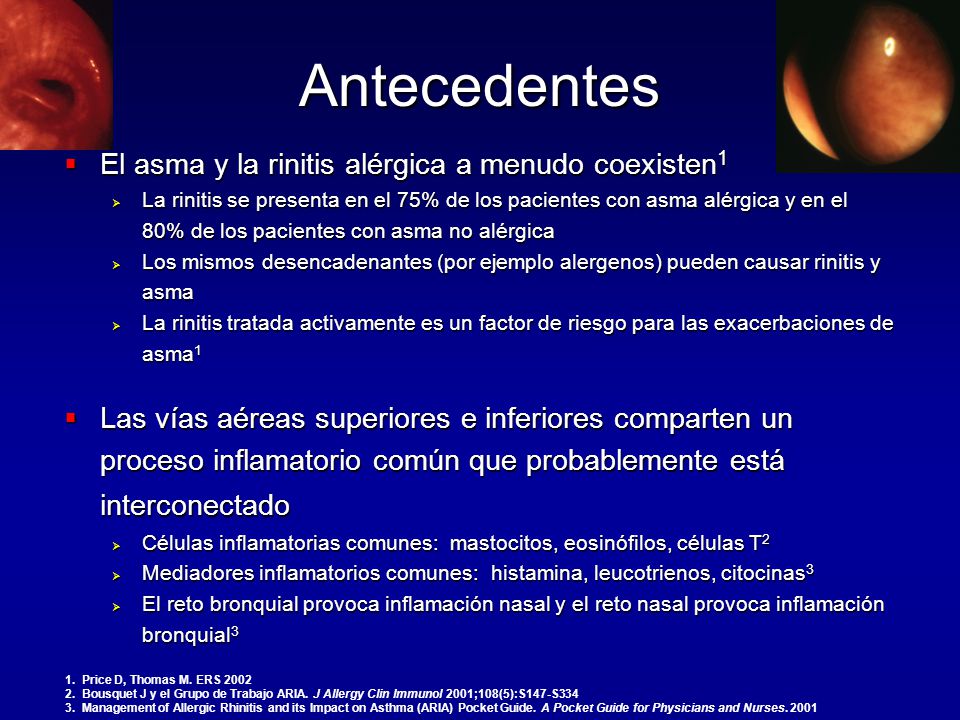 Antecedentes El asma y la rinitis alérgica a menudo coexisten1