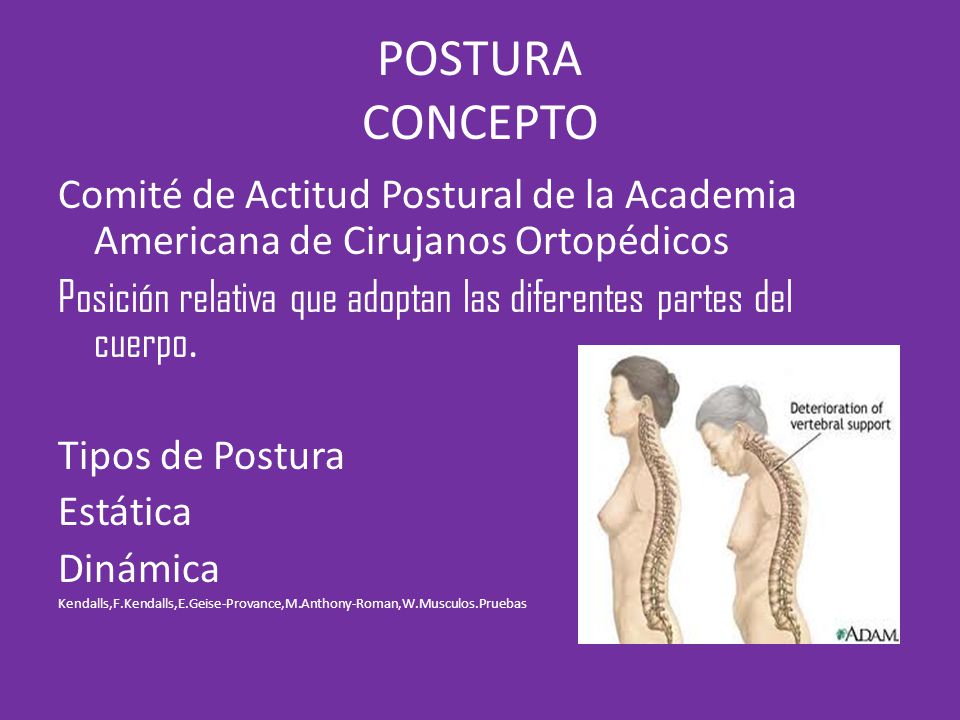 POSTURA CONCEPTO Comité de Actitud Postural de la Academia Americana de Cirujanos Ortopédicos.