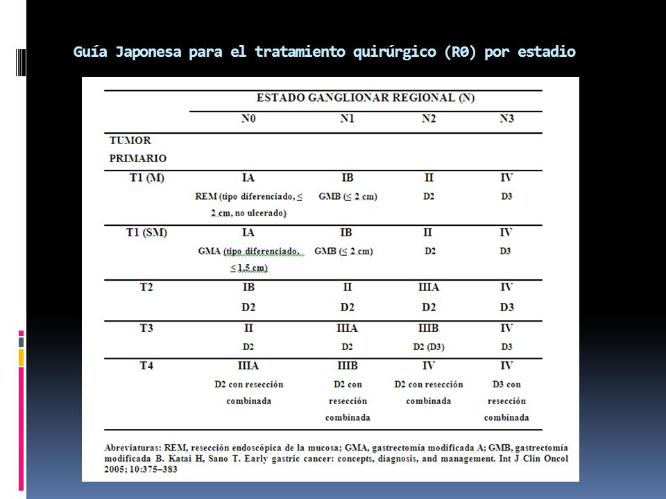 Guía Japonesa para el tratamiento quirúrgico (R0) por estadio