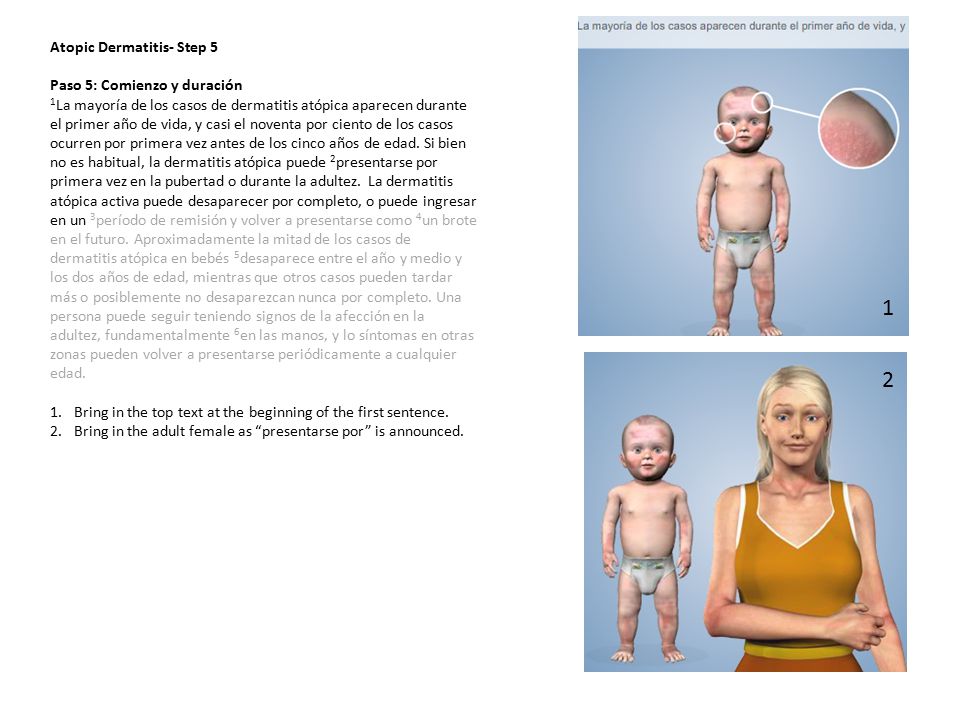 1 2 Atopic Dermatitis- Step 5 Paso 5: Comienzo y duración