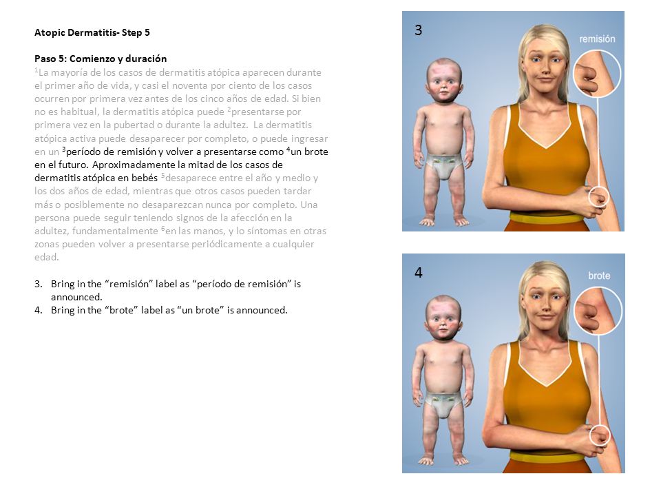 3 4 Atopic Dermatitis- Step 5 Paso 5: Comienzo y duración