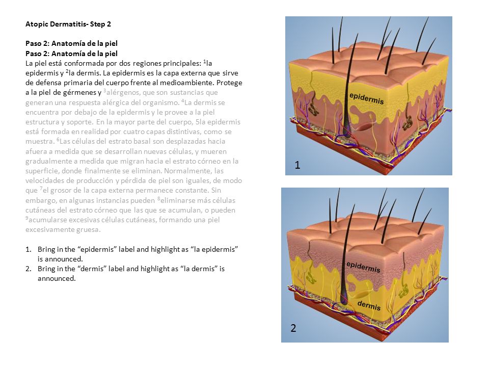 1 2 Atopic Dermatitis- Step 2 Paso 2: Anatomía de la piel
