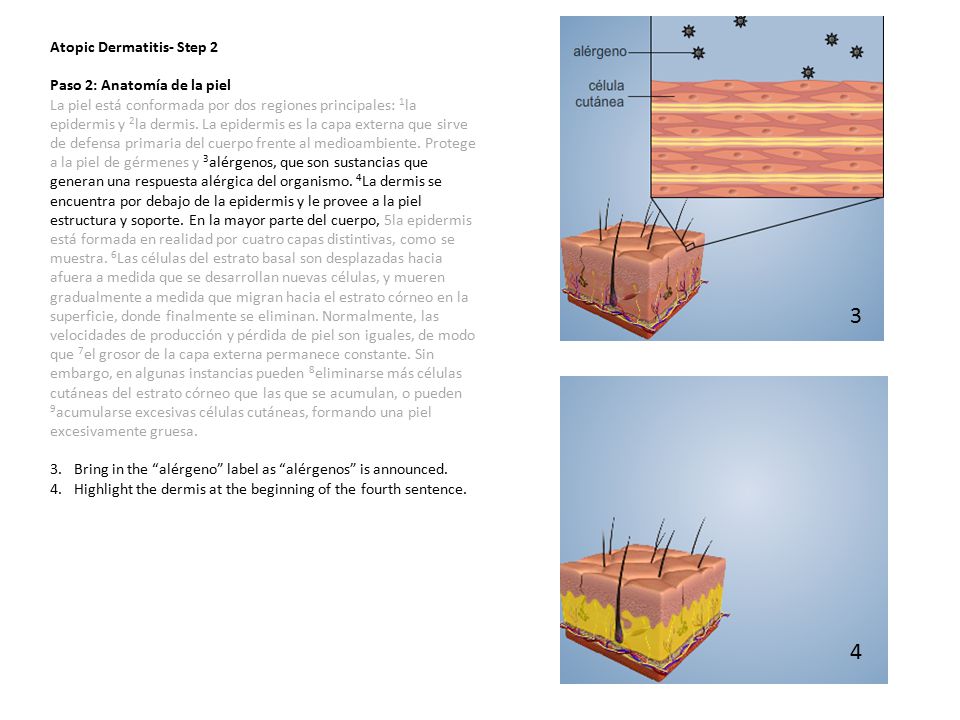 3 4 Atopic Dermatitis- Step 2 Paso 2: Anatomía de la piel