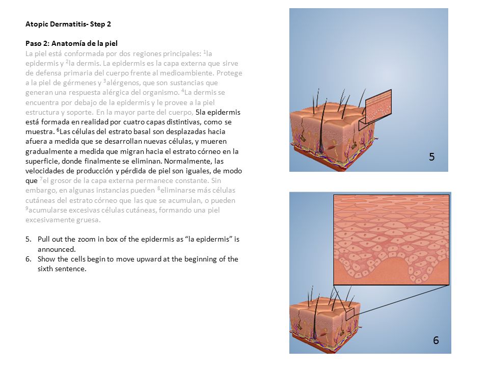 5 6 Atopic Dermatitis- Step 2 Paso 2: Anatomía de la piel