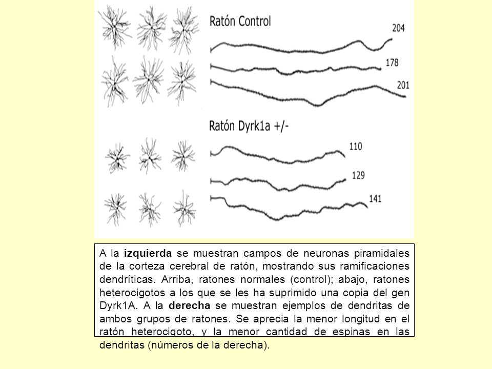 A la izquierda se muestran campos de neuronas piramidales de la corteza cerebral de ratón, mostrando sus ramificaciones dendríticas.