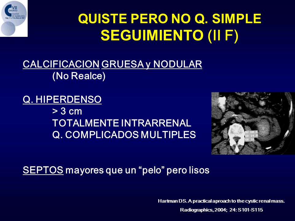 Hartman DS. A practical aproach to the cystic renal mass.