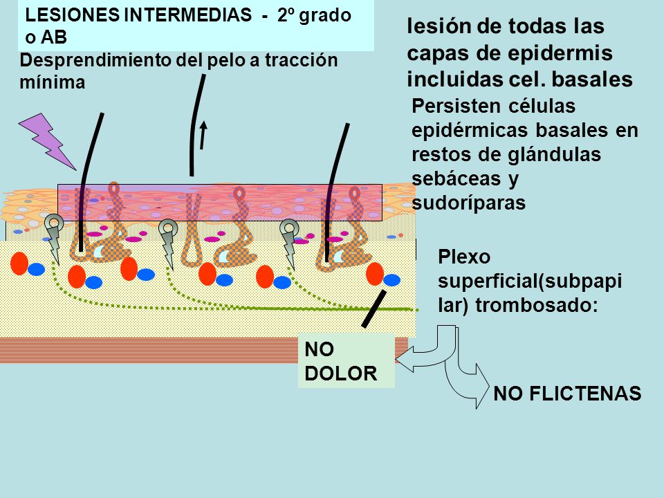 lesión de todas las capas de epidermis incluidas cel. basales