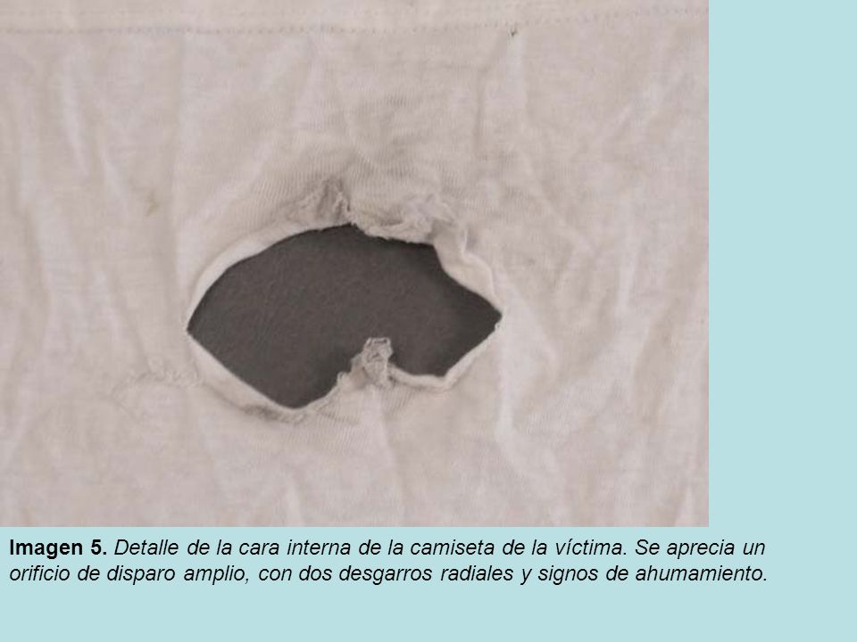 Imagen 5. Detalle de la cara interna de la camiseta de la víctima