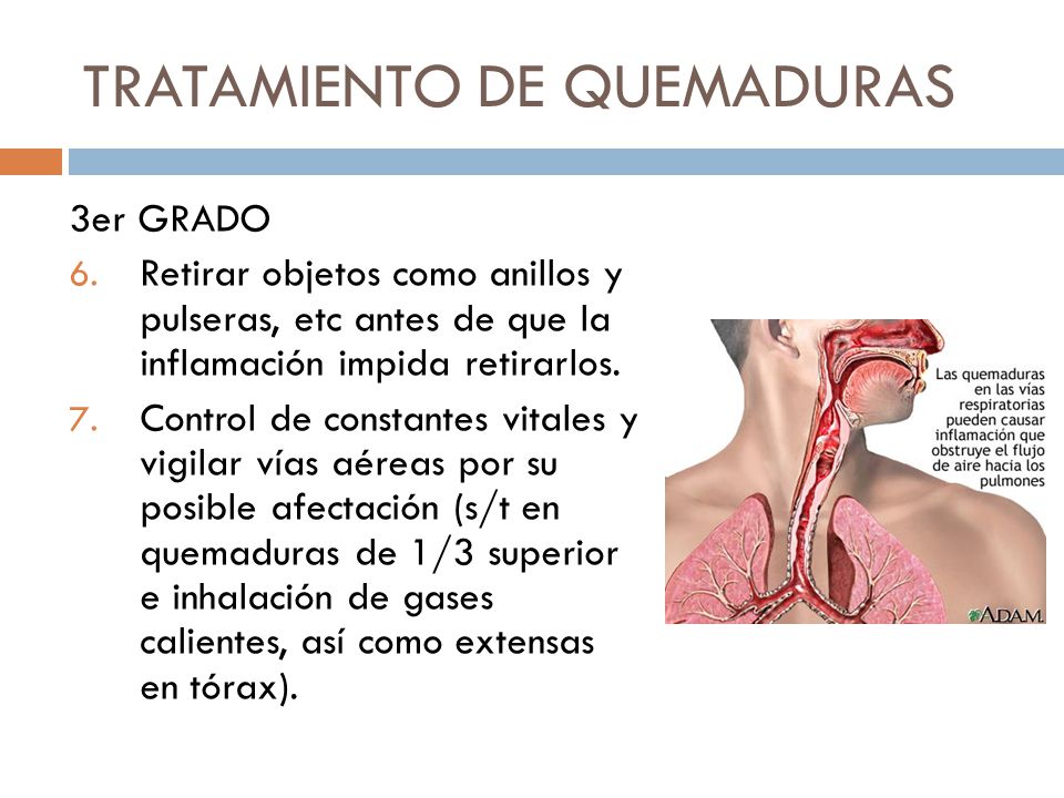TRATAMIENTO DE QUEMADURAS