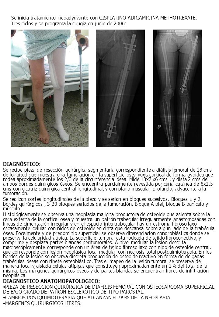 Se inicia tratamiento neoadyuvante con CISPLATINO-ADRIAMICINA-METHOTREXATE. Tres ciclos y se programa la cirugía en junio de 2006: