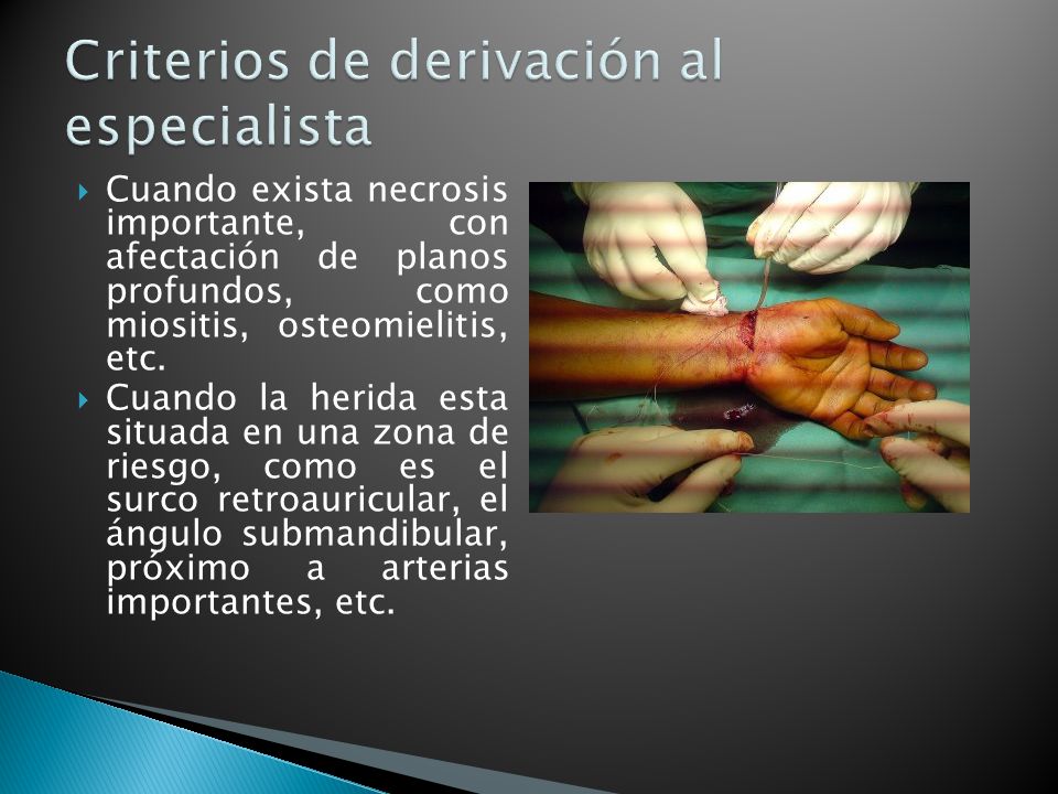Criterios de derivación al especialista