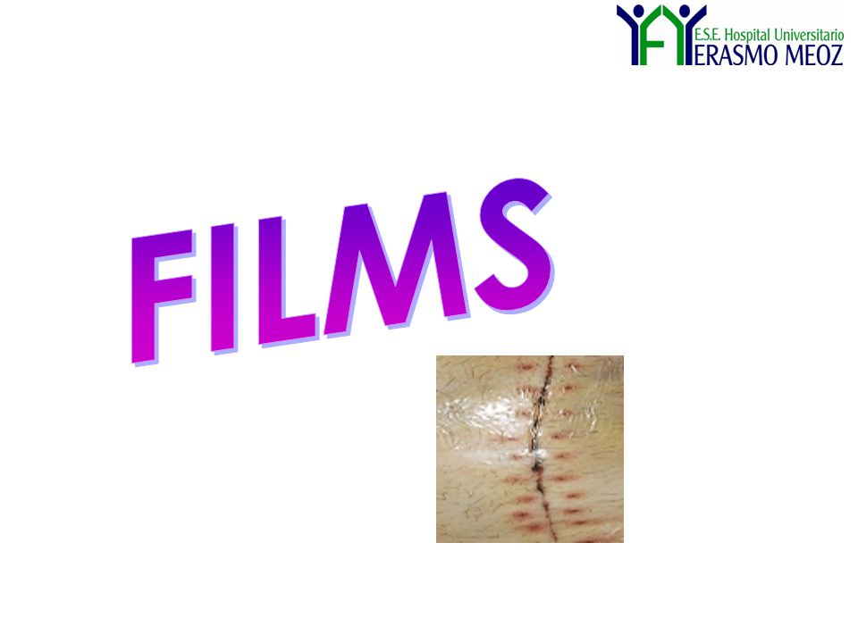 FILMS